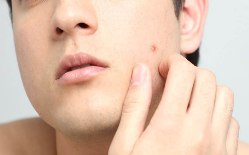 Biểu hiện trong sự thay đổi nam giới