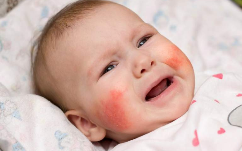 Uống thuốc khi cho con bú và dị ứng
