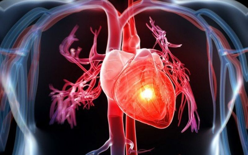 Làm giảm các vấn đề sức khỏe liên quan đến tim mạch